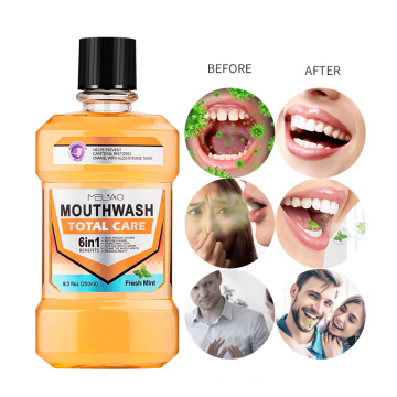 Dental Care Bad Breath Treatment Mint Refreshing Mouthwash